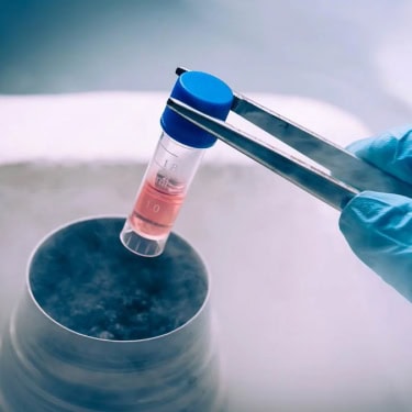 Male Infertility Image